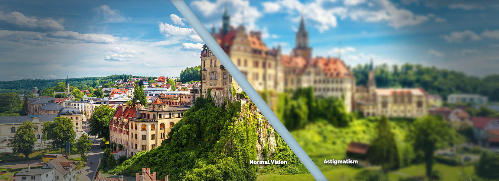Astigmatism Treatment in Huron