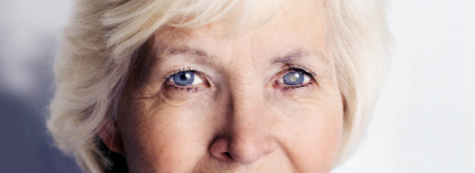 Cataract Surgery in Huron